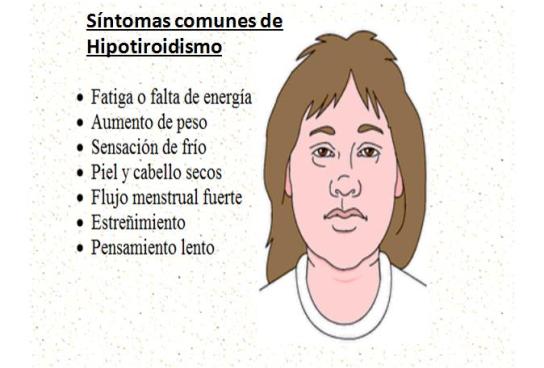 Hipotiroidismo