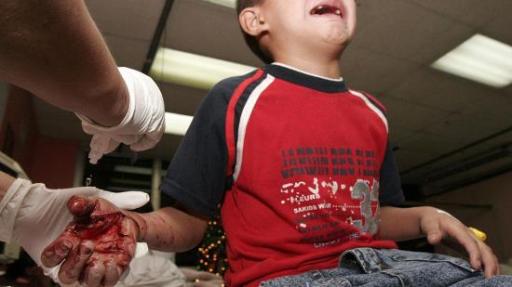 accidente pirotecnia