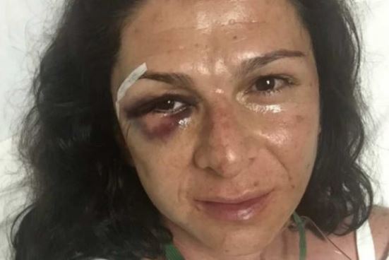 ana-guevara-agresion